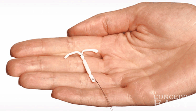 How to Get Pregnant with Paragard