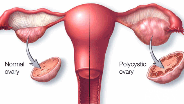 How to Get Pregnant with PCOS and no Period