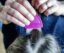 How to Treat Lice in Children's Hair