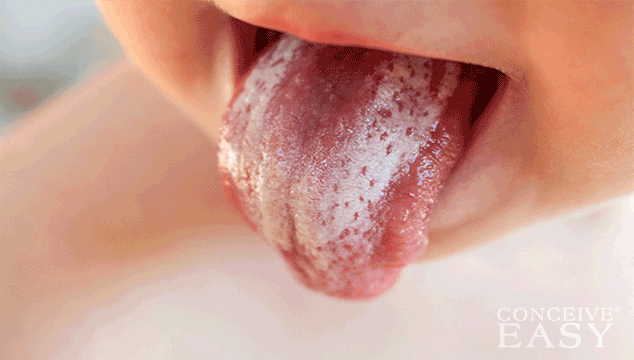 How to Treat Thrush in Children's Mouth