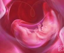 Pregnancy Problems: Too Much Amniotic Fluid