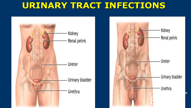 Is Hemorrhoids Related to Urinary Tract Infection?