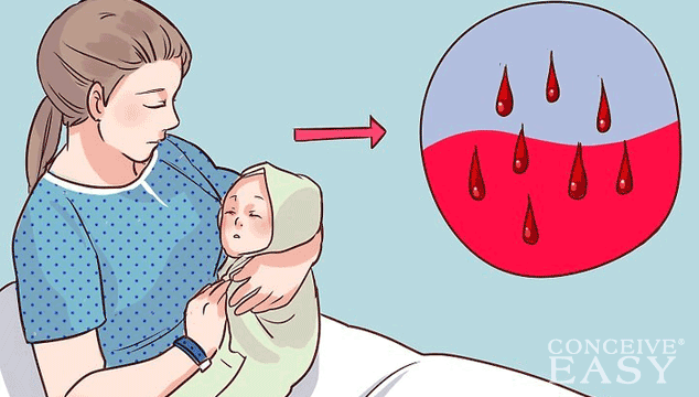 What Does Lochia Discharge Look Like?