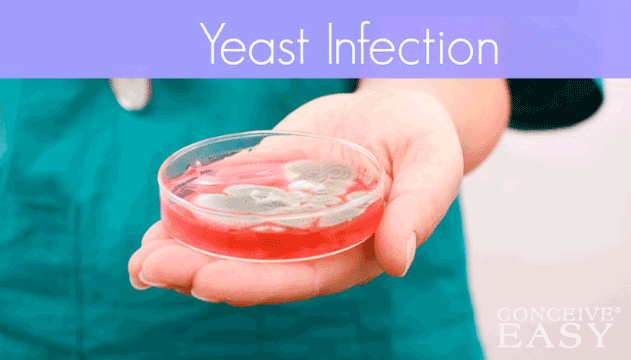 Yeast Infection and Hemorrhoids While Pregnant