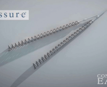 Can I get Pregnant with Essure?