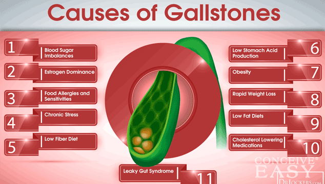 Can I get Pregnant with Gallstones?