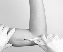 Can I get Pregnant with Implant in My Arm?