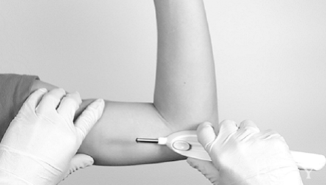 Can I get Pregnant with Implant in My Arm?