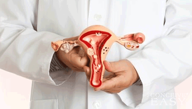 Can I get Pregnant with Menorrhagia?