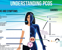 Can I get Pregnant with PCOS and No Periods?