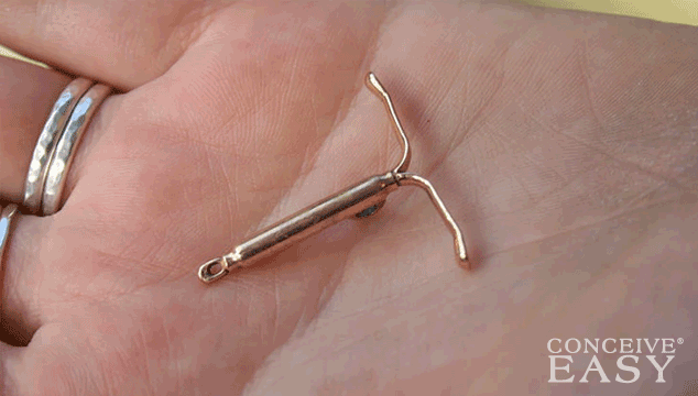 Difficulty Getting Pregnant after IUD