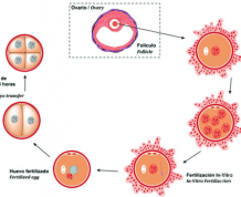 Is In Vitro Maturation (IVM) a Better Alternative to IVF?