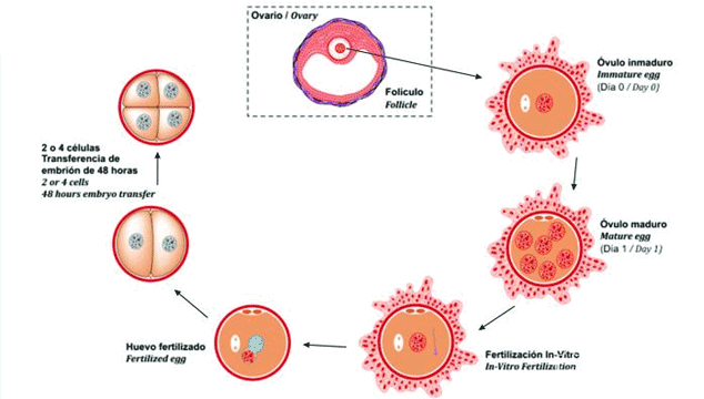 Is In Vitro Maturation (IVM) a Better Alternative to IVF?