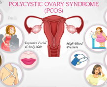 PCOS And Getting Pregnant