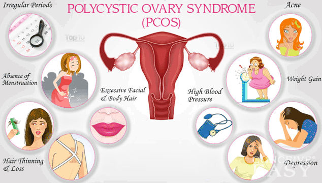 PCOS And Getting Pregnant