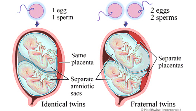 what's the difference between fraternal and identical twins?