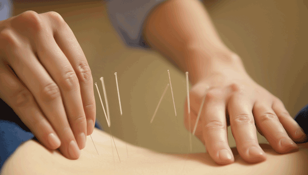 acupuncture as natural fertility treatment to get pregnant