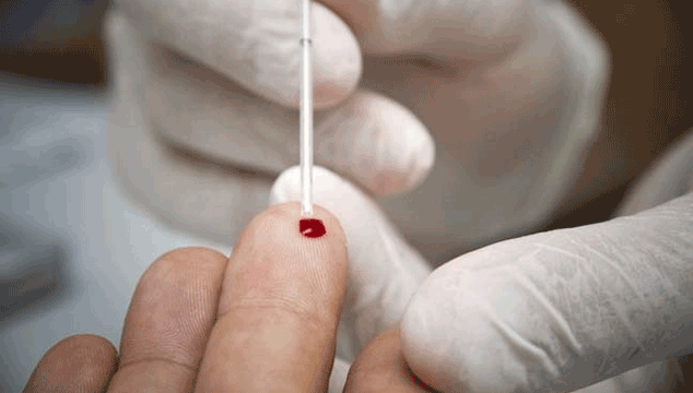 Blood Progesterone Test to determine ovulation