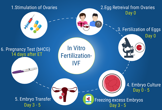 in vitro fertilization procedure and time frame