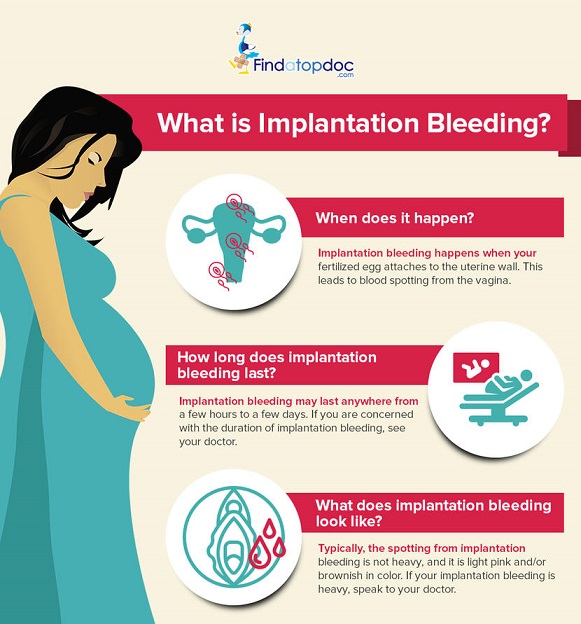 what is implantation bleeding and how does it last?