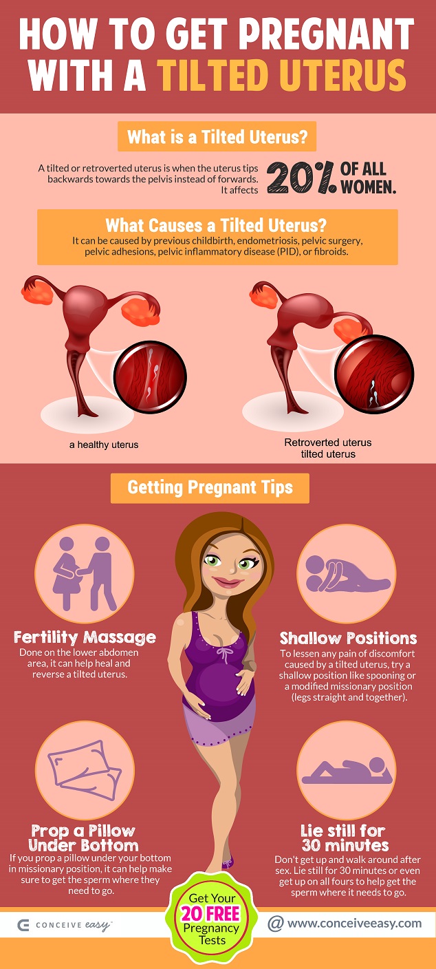 How to Get Pregnant with a Retroverted Uterus Infographic