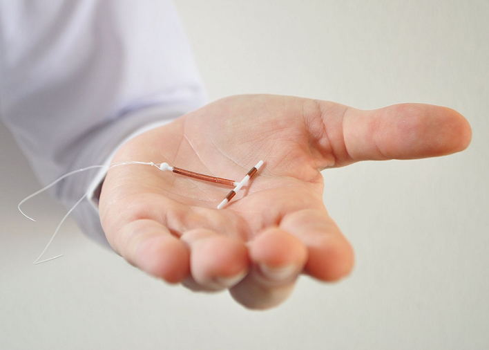 Birth control IUD