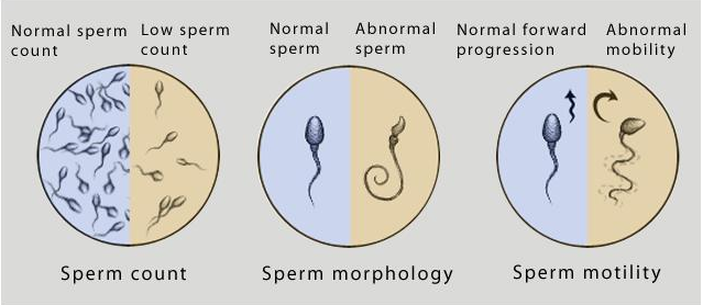 semen analysis