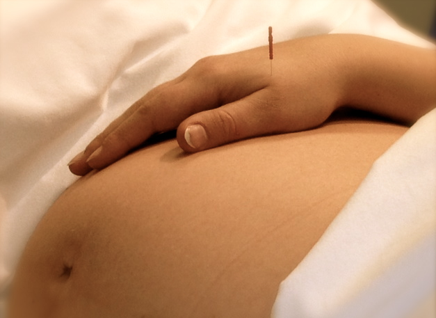 Acupuncture and Acupressure To Induce Labor