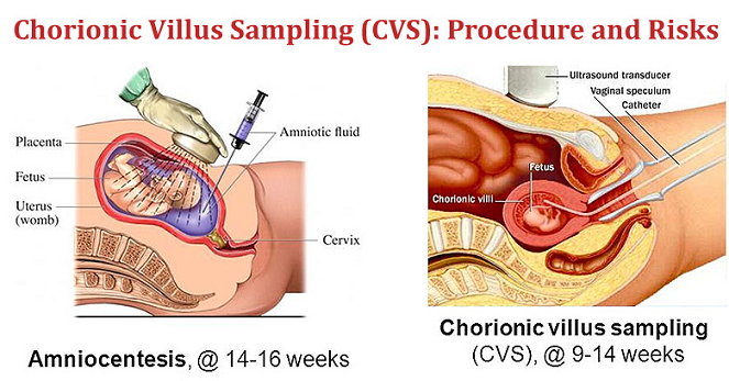 CVS Test