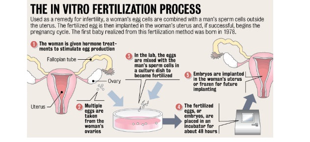 IVF procedure