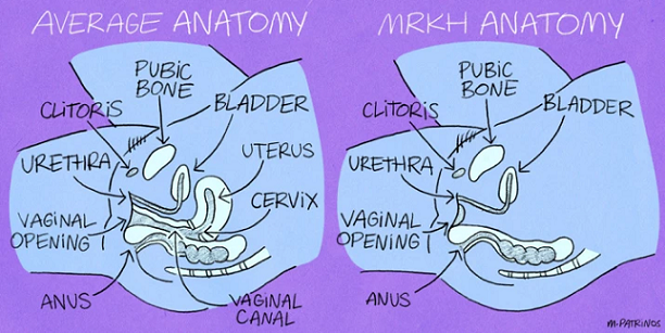 MRKH syndrome