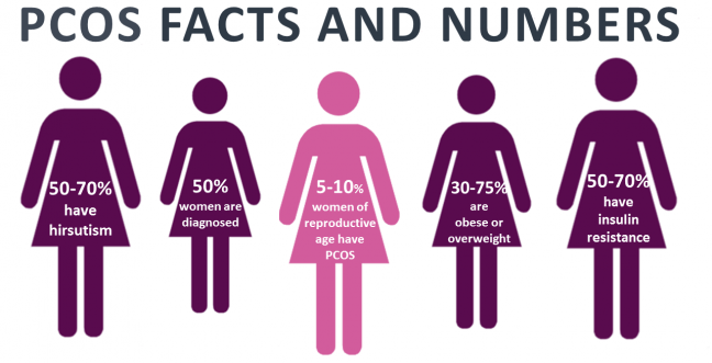 PCOS and infertility