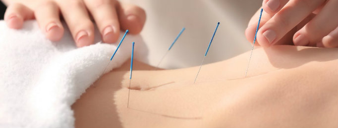 acupuncture for fertility