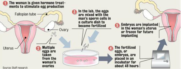 fertility medication procedure