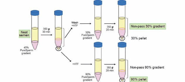 sperm washing
