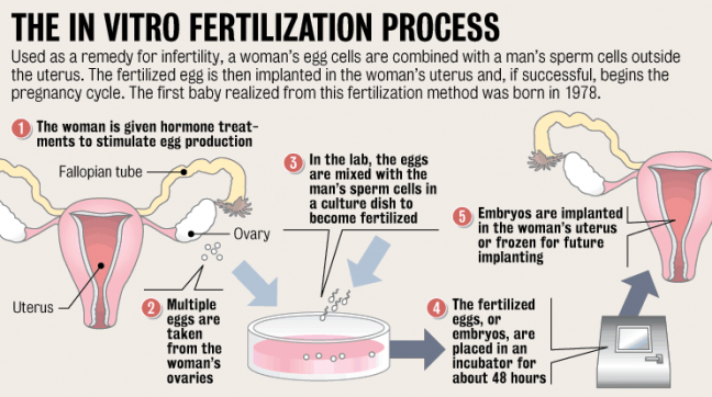 In Vitro Fertilization