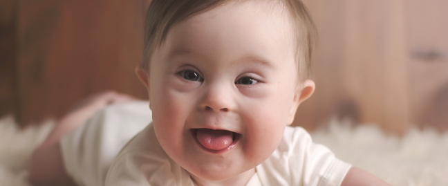 One of the risks you are probably aware of when you conceive in your 40's is the increased odds of having a child with Down's Syndrome