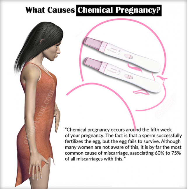 chemical pregnancy