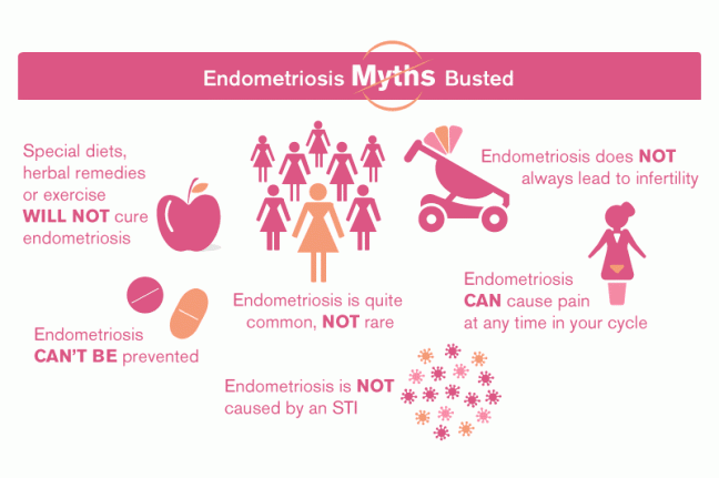 Myths about Endometriosis