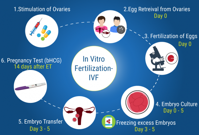 in vitro fertilization