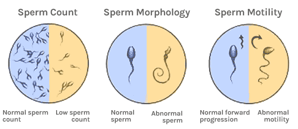 poor sperm quality