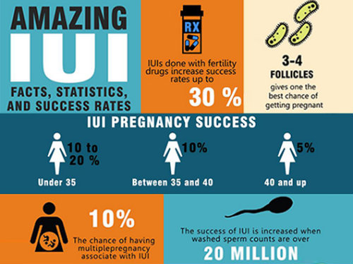 IUI procedure