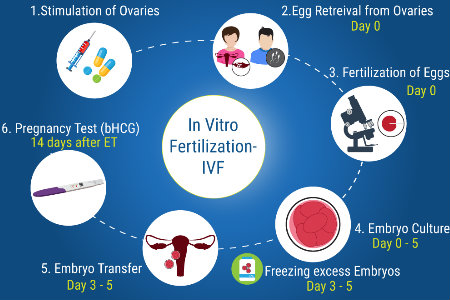 in vitro fertilization