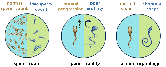 Semen analysis - IUI