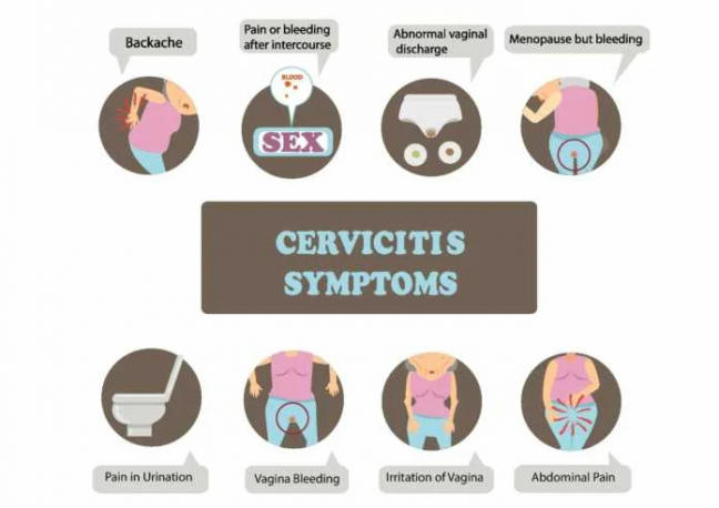 cervicitis symptoms - cause of mid-cycle spotting