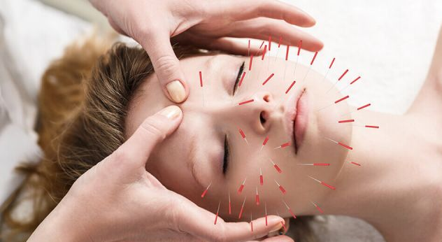 can-acupuncture-boost-your-fertility